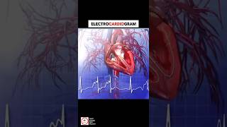 ElectroCardioGram ECG  cardiology [upl. by Wagshul924]