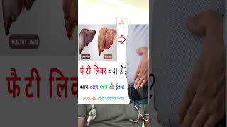 Fatty Liver  Fatty Liver Symptoms shorts liver liverdisease homeopathicmedicine gastro short [upl. by Burta]