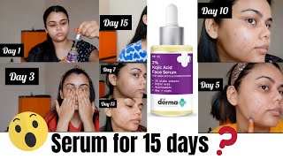 The Derma Co 2 Kojic Acid Face Serum  Treats Hyper Pigmentation  Dark Spots amp Blemishes JAHNABI [upl. by Heddie]