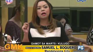 Gamot sa warts kulugo [upl. by Atnohs]