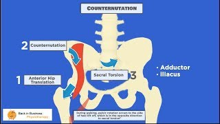 Pelvic Malalignment [upl. by Ibbor]