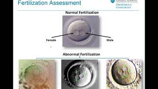 Embryo Selection and Transfer  Mass General Fertility Focus Webinar [upl. by Olivier]