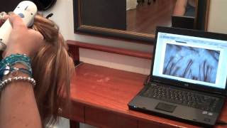 Hair Health Check amp Scalp Check with Brisbane Trichologist [upl. by Artema]