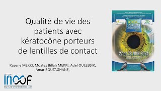 Qualité de vie des patients avec Kératocône porteurs de lentilles de contact [upl. by Rushing]