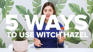 5 WAYS to use WITCH HAZEL  5things5WAYS [upl. by Undis]