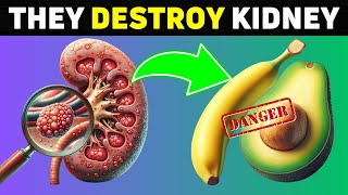 These 15 FOODS are Destroying Your Kidney Health  Number 4 Will Surprise You [upl. by Nylyaj]