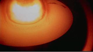 Castle Bravo  Huge thermonuclear explosion [upl. by Annot]