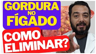 O que fazer para eliminar gordura no fígado esteatose hepática  Tratamento  Prof Victor Proença [upl. by Oringas]