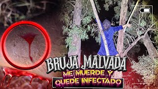 BRUJA MALVADA ME MUERDE Y QUEDO INFECTADO [upl. by Afatsuom]