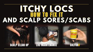 How to Fix Itchy Locs and Scalp SoresScabs [upl. by Virgin984]