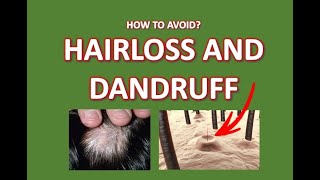 Dandruff and Thinning Hair What is the Link [upl. by Aneloj]