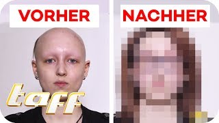 Antonia 19 hat extremen Haarausfall  Kann man ihr helfen SOS  Einsatz der BeautyRetter  taff [upl. by Ettari983]