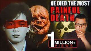 वो अपने मरे शरीर में 83 Days तक तड़पता रहा The Most Painful and Scary Story of Hisashi Ouchi [upl. by Vinni181]