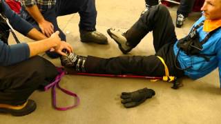 Ski Pole Traction Splint Tutorial [upl. by Noreik]