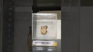 Museum specimen நோயியல் அருங்காட்சியகம்  museum sample histomuseum histopathology [upl. by Hafinah]