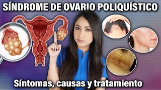 Síndrome de Ovario Poliquístico Causas SÍNTOMAS y TRATAMIENTO 👩🏻‍⚕️l Dra Pau Zúñiga [upl. by Hatty]