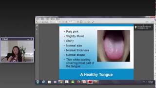 Traditional Chinese Medicine Webinar Tongue Diagnosis [upl. by Caniff]