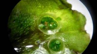 Liverwort Gemmae Cups [upl. by Hein]