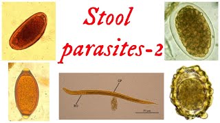 Stool parasitespart 2  Nematodes  Round worm  Pin worm  Hook worm  Whip worm  Thread worm [upl. by Lole]