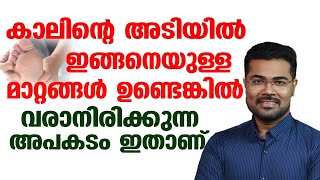 കാലിന്റെ അടിയിൽ ഇങ്ങനെയുള്ള മാറ്റങ്ങൾ മാറ്റങ്ങൾ ഉണ്ടെങ്കിൽ വരാനിരിക്കുന്ന അപകടം ഇതാണ് [upl. by Arlon957]