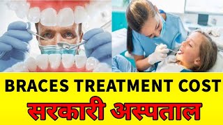 Cost of Braces treatment in Government Hospital  सरकारी अस्पताल में ब्रेसेस के इलाज का खर्च [upl. by Aiket]