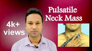 Pulsatile Neck Mass Aetiologies and Diagnosis [upl. by Edia613]