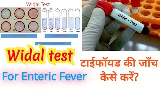 Widal test in hindi [upl. by Haem]