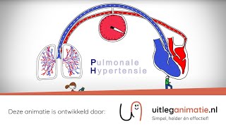 Uitleganimatie  VUmc Pulmonale Hypertensie [upl. by Tnomyar]