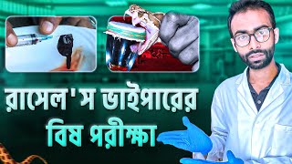 রাসেলস ভাইপারের বিষ মানুষের শরীরে কি ঘটায় সাপে কাটলে যেসব ভুল করা যাবে না Sabbir Ahmed [upl. by Frendel]