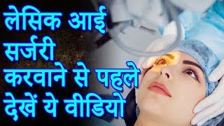 lasik laser eye surgery  लेसिक आई सर्जरी के फायदे और नुकसान  Lotus Ayurveda India [upl. by Maillliw616]