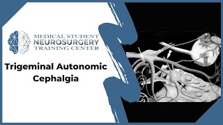 Trigeminal Autonomic Cephalgia [upl. by Afas]