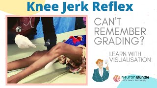 knee jerk reflex I all 4 grades with demo on patients I brisk tendon reflex rootvalue I neurology [upl. by Blancha534]