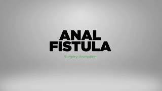 Laser Anal Fistula Treatment Malaysia  Minimally Invasive No Incontinence Fast Recovery [upl. by Tedd]