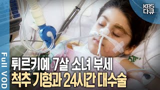 선천적 척추 기형 12시간 장거리 비행 24시간 대수술 마지막 희망을 안고 한국에 온 7살 튀르키예 소녀 부세  현장기록 병원  KBS 20070121 방송 [upl. by Siouxie]