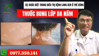 Sự khác biệt trong điều trị bệnh lang ben ở trẻ bằng thuốc bong lớp da nấm [upl. by Tallula]