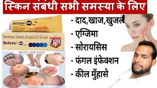 मात्र 5 दिन मे दाद खाज खुजली जड़ खत्म ।। dad khaj khujali ki dava ।। Betzee gm cream uses Hindi [upl. by Thorrlow]