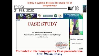 Thrombotic microangiopathy Case presentation prof Walaa Hosny [upl. by Eyssej843]