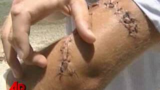 Florida Man Speaks Out After Shark Attack [upl. by Mahala]