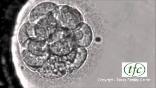 Human Embryo Growing from Fertilization to Day 6 Blastocyst [upl. by Reneta]