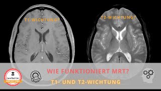 Wie funktioniert MRT T1 und T2 Wichtung [upl. by Tella]