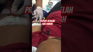 Dialysis procedure shortvideo hospital hemodialisa gagalginjal cucidarah kidneydisease shorts [upl. by Winston]