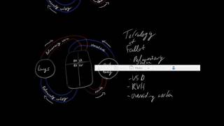 Congenital Heart defects Cyanotic and Acyanotic [upl. by Peppie]