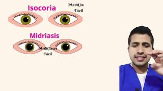 Isocoria  anisocoria  midriasis  Miosis [upl. by Selrhc]