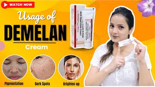 Demelan Cream  Best Pharmacy Cream For Dark Spots and Pigmentation  Glycolic Acid  skincare [upl. by Rap]