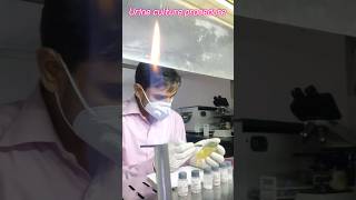 Urine culture and sensitivity test shortvideo [upl. by Egdirdle360]