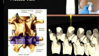 Regional Anesthesia  Ultrasound Assisted  Guided Neuraxial Block [upl. by Darraj643]