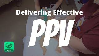 Delivering Effective PPV for Neonatal Resuscitation  NRP Mastery for Nurses [upl. by Arracahs704]