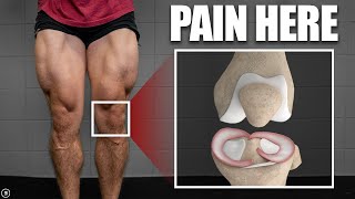 Meniscus Tear Rehab amp Exercises Stretching  Strength  Plyometrics [upl. by Emyle327]