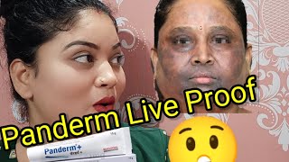 Panderm Live Proof  ये क्या हो गया  अगर आप भी लगाते है तो हो जायें सावधान। [upl. by Ulrika]