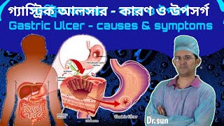 গ্যাস্ট্রিক আলসার  কারণ ও উপসর্গ  Gastric Ulcer  causes amp symptoms  Drsun [upl. by Theall]